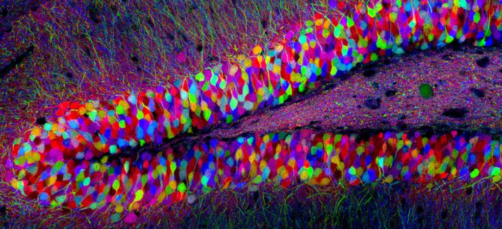 fluoreszenzmikroskopische Aufnahme von Nervenzellen (Neuronen) im Gehirn